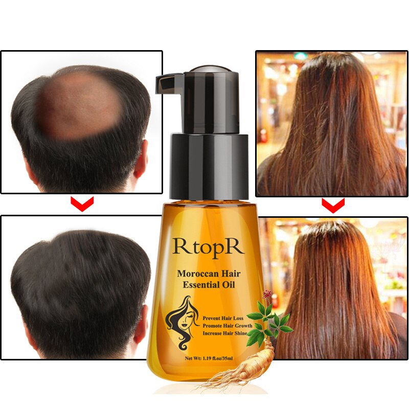 Xpoko Moroccan Prevent Hair Loss Product Hair Growth Essential Oil Damaged  Care Repair Nursing 35ml Fast Hair Growth Oil