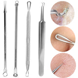 Xpoko Stainless Steel Acne Removal Needles Pimple Blackhead Remover Tools Spoons Face Skin Care Tools Needles Facial Pore Cleaner