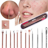 Xpoko Blackhead Comedone Acne Needle Remover Tool Kit Clip Pimple Spoon for Face Skin Care Tool Needles Facial Pore Cleaner