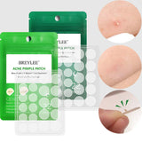 Xpoko Invisible Acne Patch Removal Pimple Treatments Sticker Facial Mask Suitable Day and Night Waterproof Skin Care Tools 22 Patches