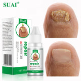 Xpoko 20ML Nail Fungal Treatment Feet Care Essence Nail Foot Toe Nail Fungus Removal Gel Anti Infection Paronychia Onychomycosis